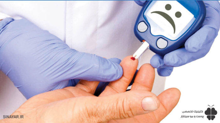 تزریق ژل برای افراد دیابتی