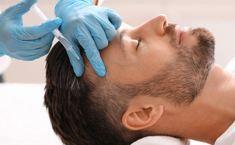 مزوتراپی مو در اصفهان