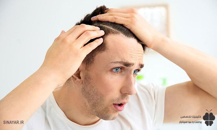 عوارض کاشت مو در بیماران تیروئید