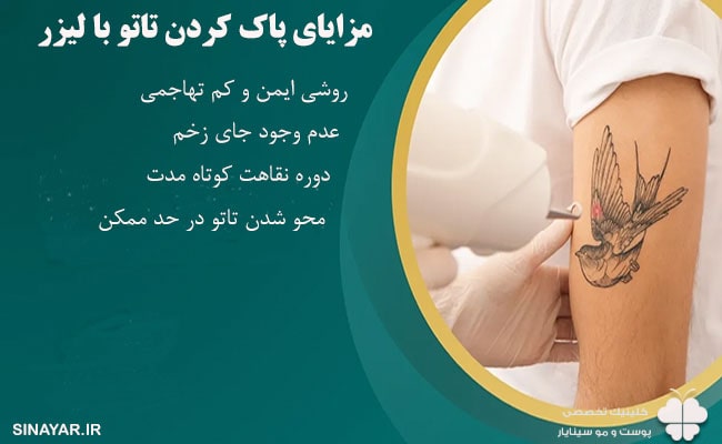 مزایای پاک کردن تاتو با لیزر