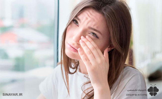  چشم درد بعد از بوتاکس 