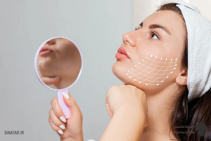 آیا من کاندیدای مناسبی برای لیفت با نخ هستم