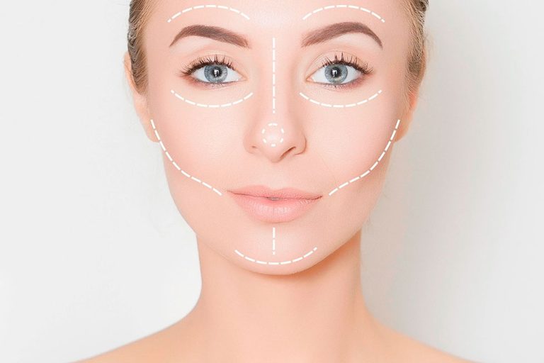 عدم تقارن صورت بعد از بوتاکس