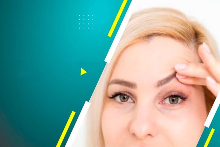 درمان افتادگی پلک بعد از بوتاکس