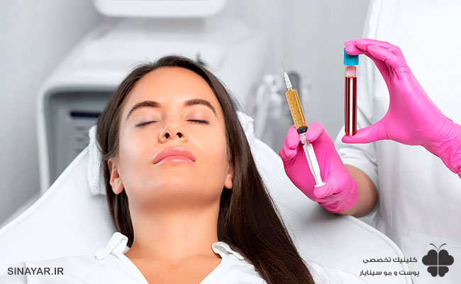 مقایسه مزوتراپی صورت با پی آر پی