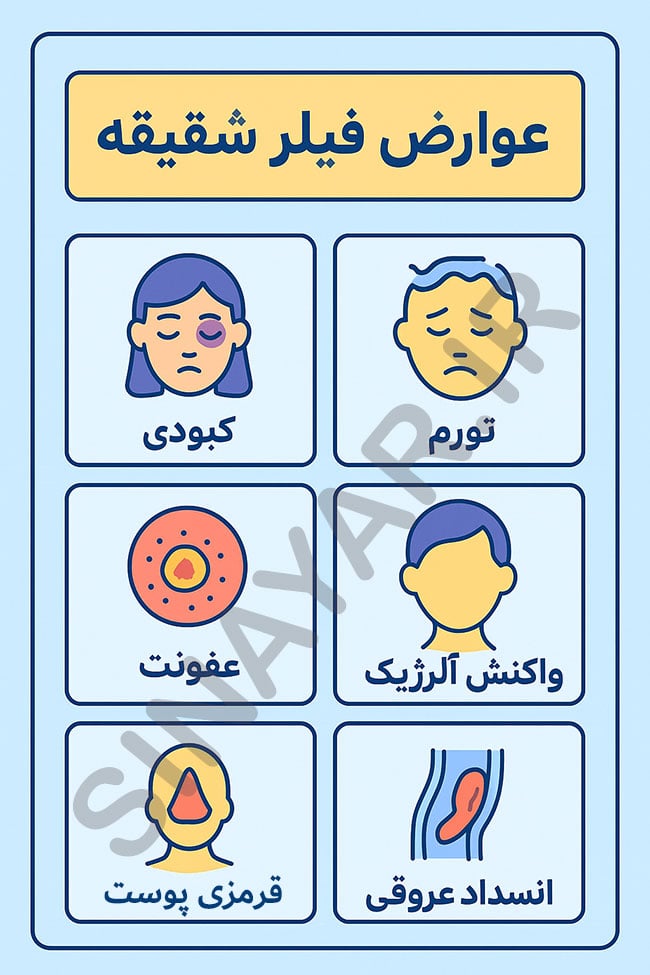 عوارض فیلر شقیقه