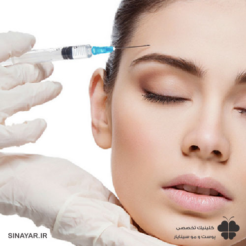تزریق ژل شقیقه برای بالا بردن ابرو