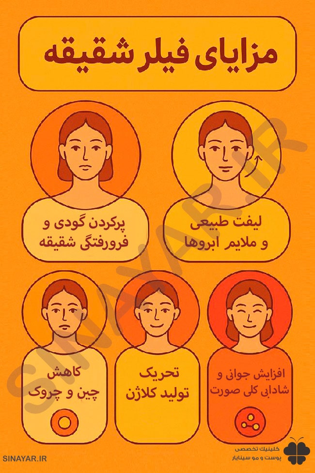 فیلر شقیقه