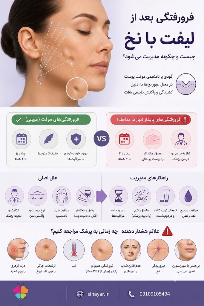 فرو رفتگی بعد از لیفت با نخ