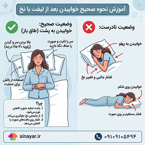 خوابیدن بعد از لیفت با نخ