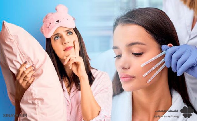 بعد از لیفت با نخ چگونه بخوابیم؟