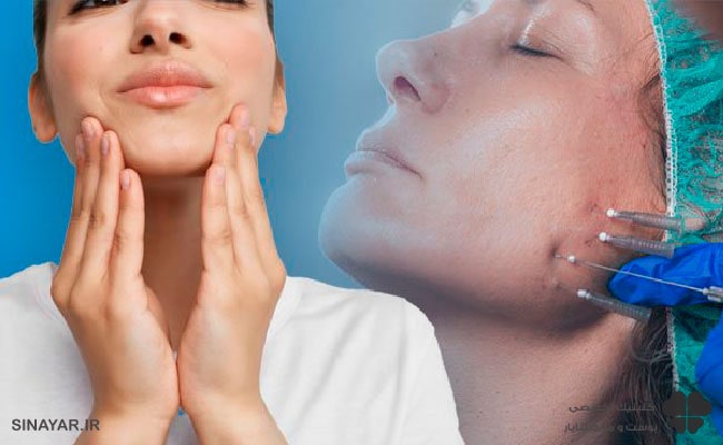 بهترین چسب ها برای لیفت با نخ