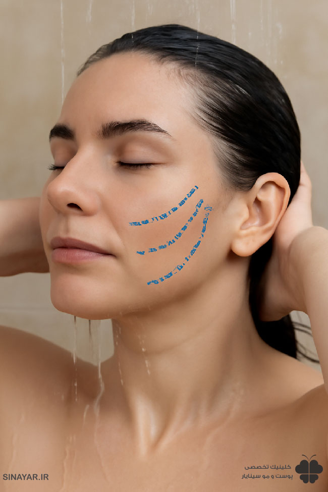 حمام رفتن بعد از لیفت با نخ صورت