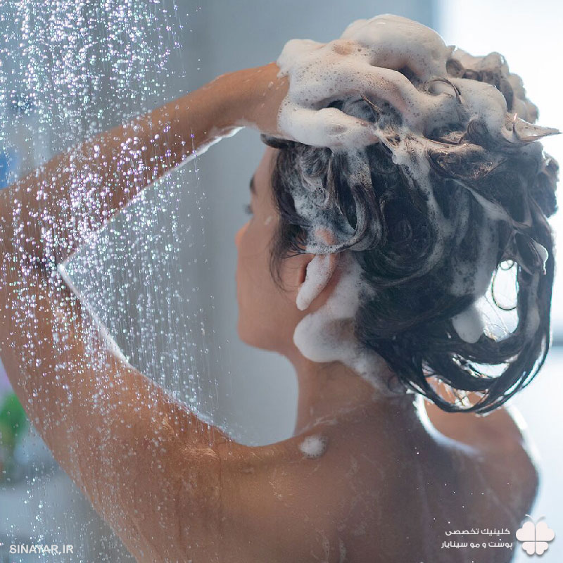 حمام کردن بعد از لیفت با نخ