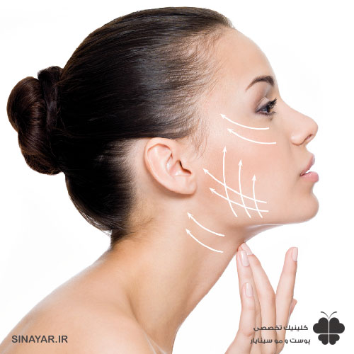 دوش گرفتن بعد لیفت نخ