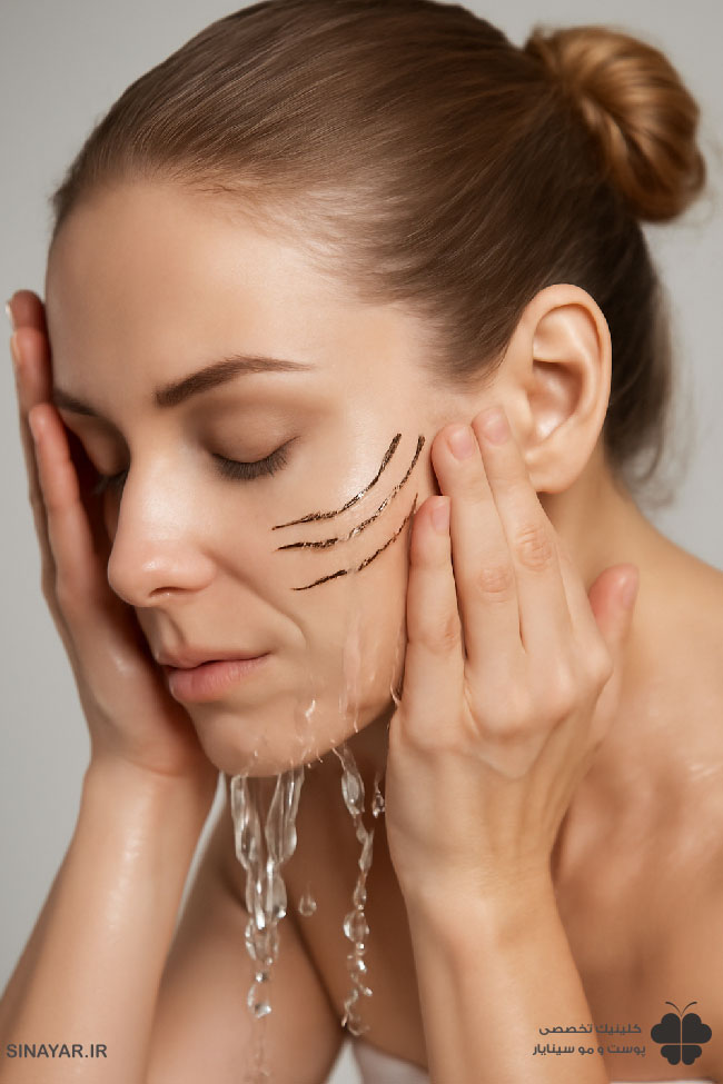 راهنمای شستن صورت بعد از لیفت با نخ+نکات طلایی