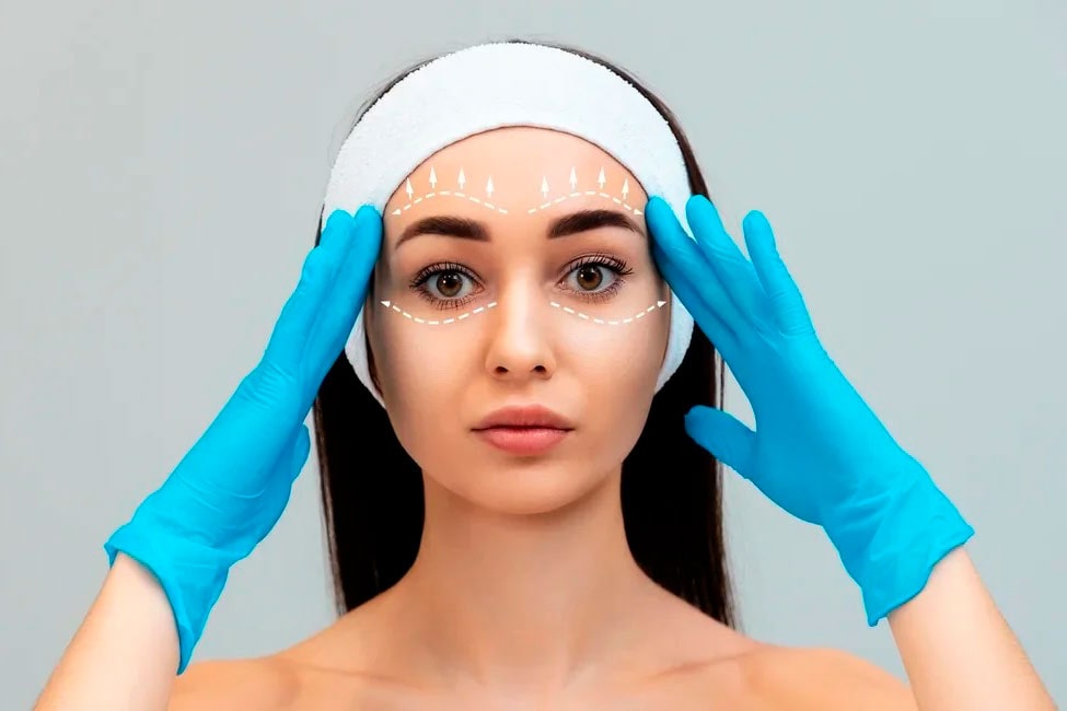 چسب زدن بعد از لیفت با نخ