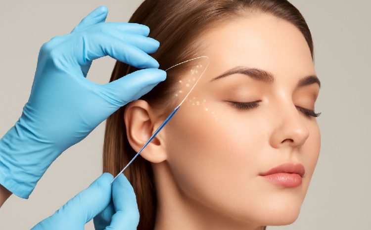 لیفت شقیقه با نخ