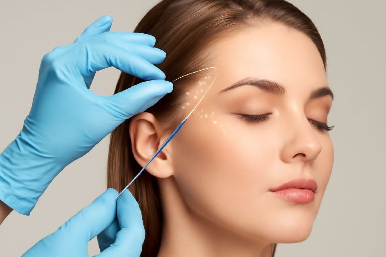 لیفت شقیقه با نخ جوانسازی سریع و بدون جراحی