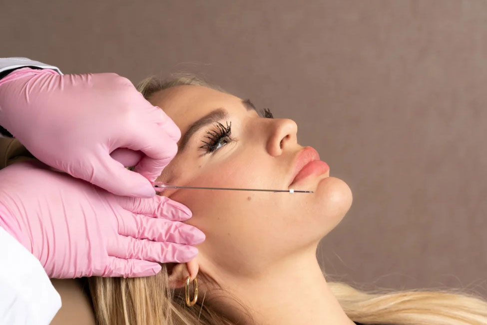 مراقبت بعد از لیفت با نخ