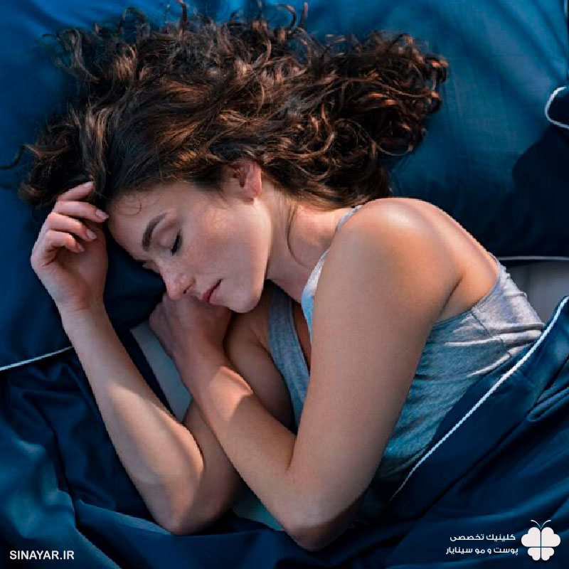 نحوه صحیح خوابیدن بعد از لیفت با نخ