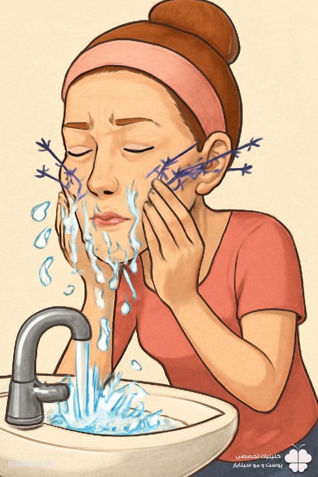 نحوه صحیح شستشوی صورت بعد از لیفت با نخ
