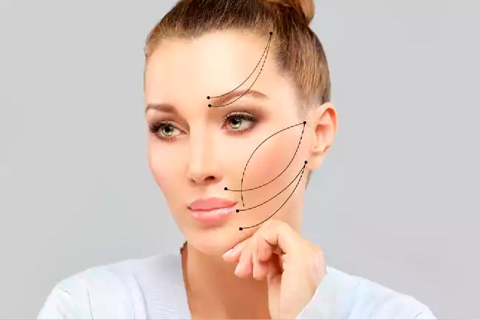 مراقبت بعد از لیفت با نخ