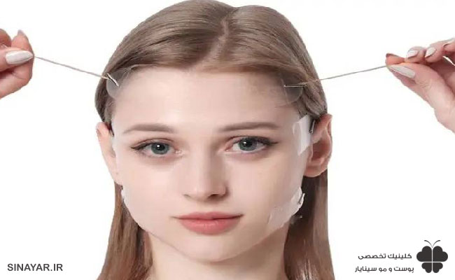 چسب زدن بعد از لیفت با نخ