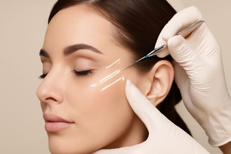 چه مواردی بر ماندگاری لیفت شقیقه با نخ تاثیرگذارند؟