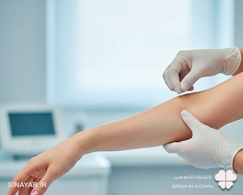 ماندگاری لیفت بازو با نخ