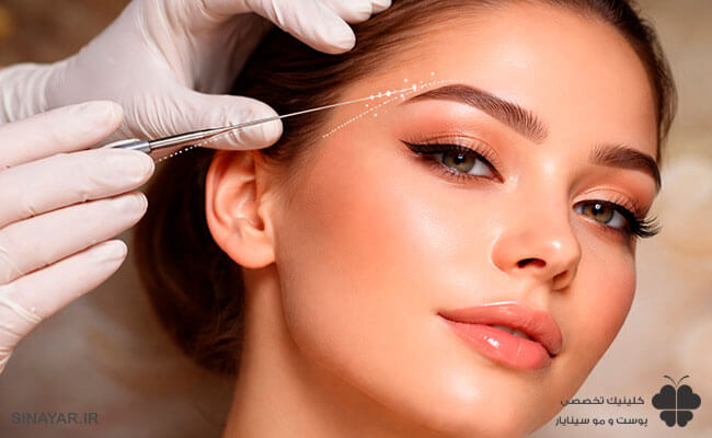 آیا لیفت ابرو با نخ عوارض دارد