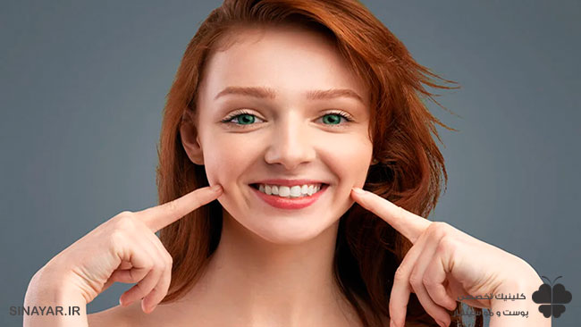 عفونت چال گونه با نخ