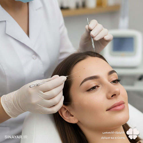 لیفت پیشانی با نخ چقدر ماندگاری دارد