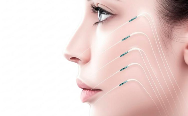 لیفت بینی با نخ