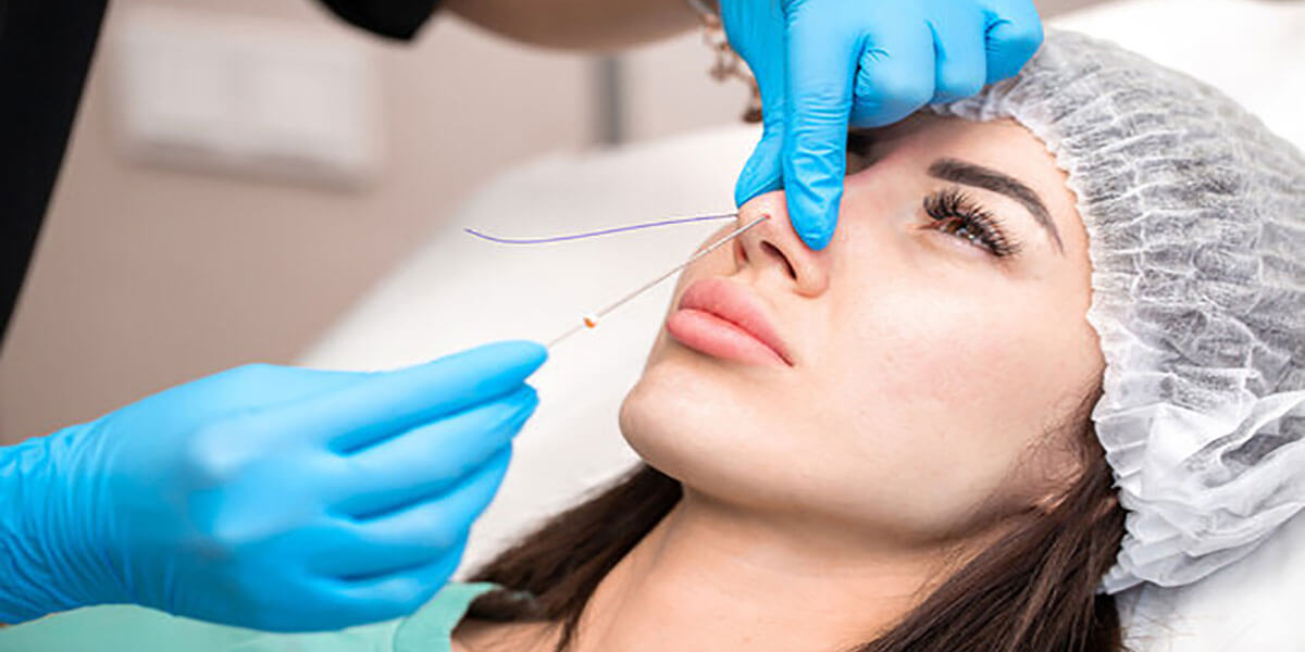 لیفت بینی با نخ در اصفهان