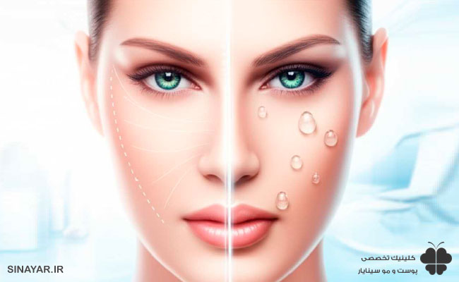 عوارض لیفت صورت با کدام روش بیشتر است؟