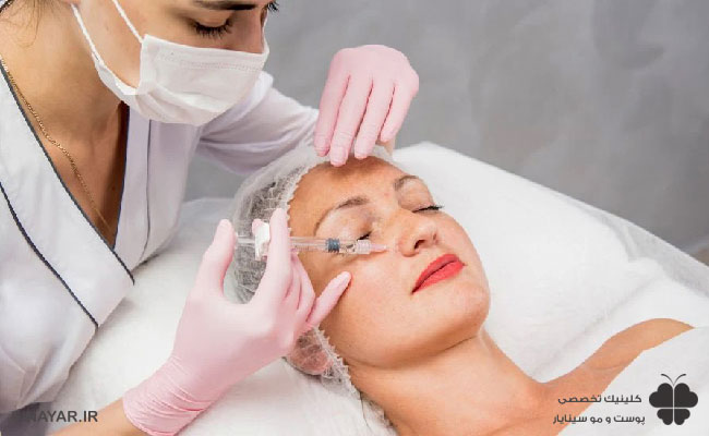 مقایسه لیفت صورت با تزریق ژل و لیفت صورت با نخ