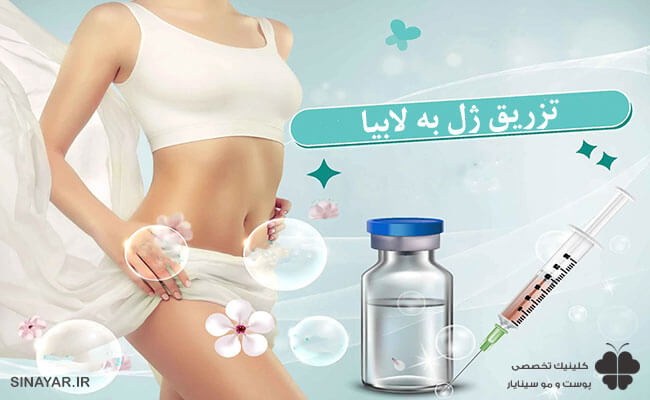 تزریق ژل به لابیا