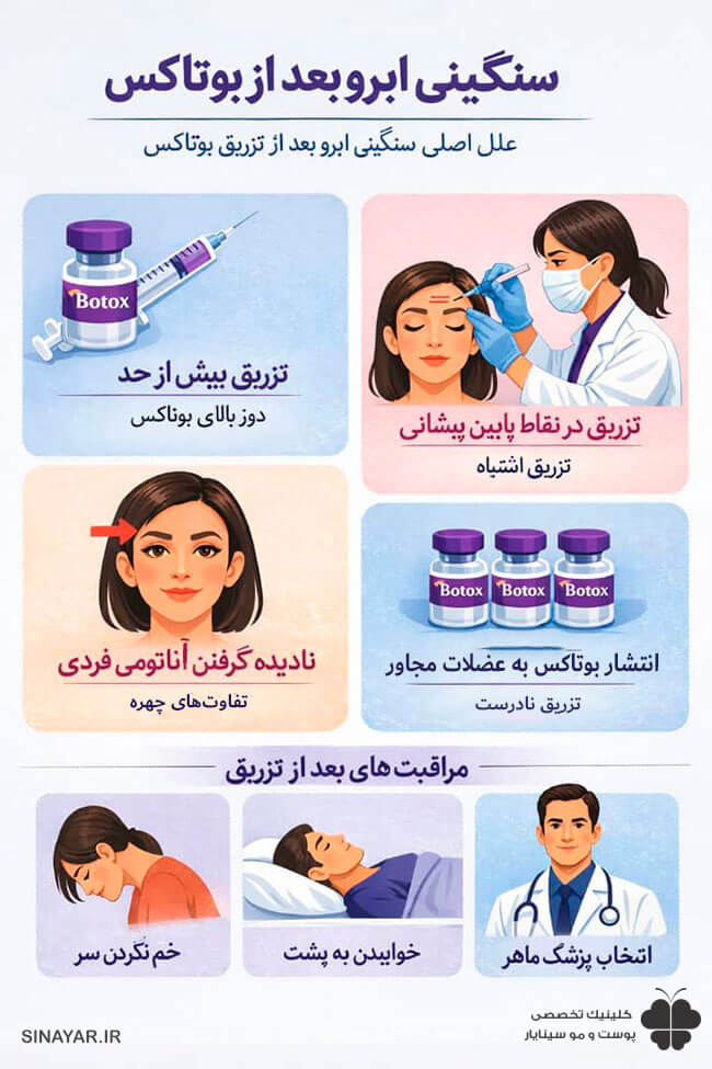 سنگینی ابرو بعد از بوتاکس