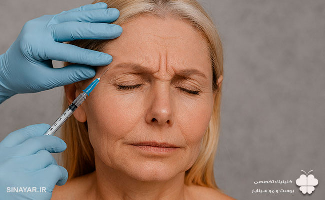 چروک بیشتر بعد از تزریق بوتاکس