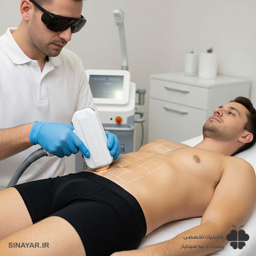 عوارض لیزر بیکینی آقایان