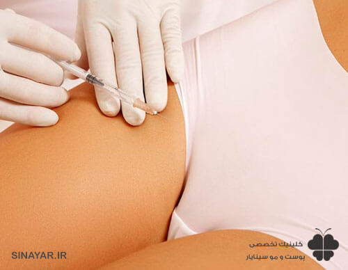 عوارض تزریق ژل به لابیا