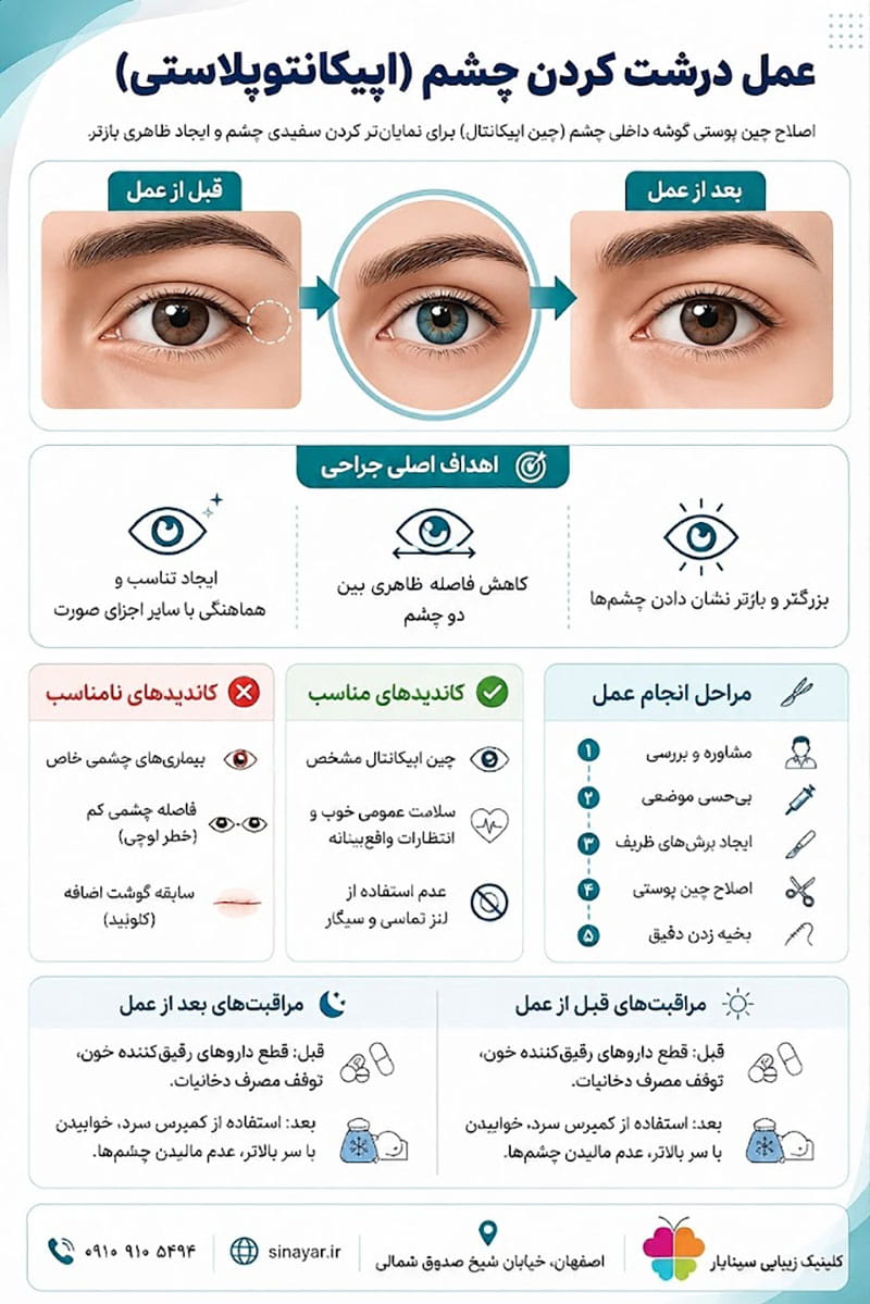 اپیکانتوپلاستی چیست