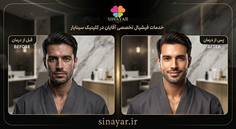 عکس قبل و بعد پاکسازی صورت مردانه