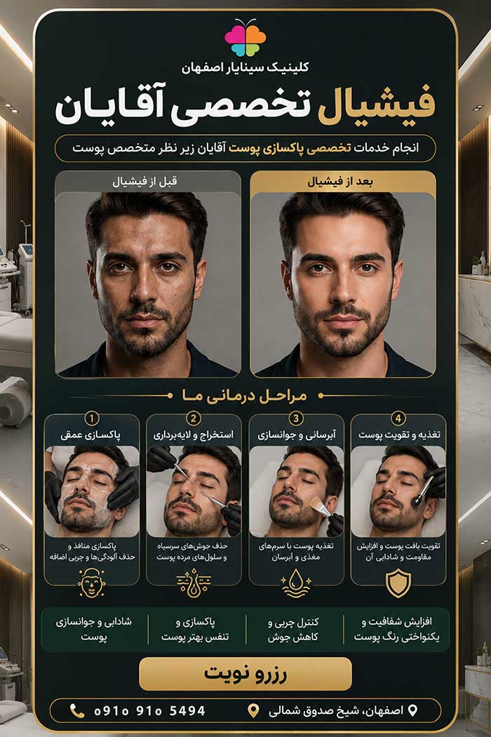 فیشیال صورت آقایان در اصفهان