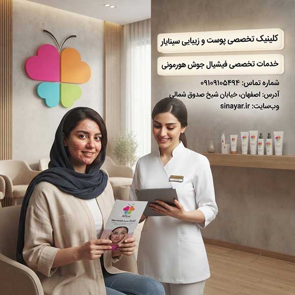 فیشیال برای جوش هورمونی خوبه