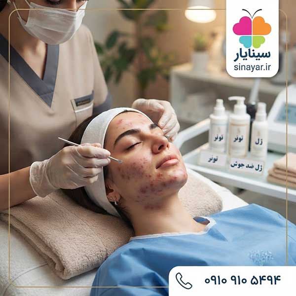 پاکسازی پوست برای جوش هورمونی