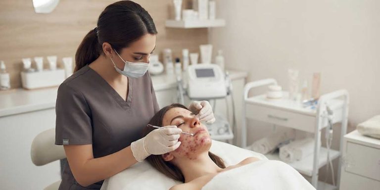 فیشیال جوش هورمونی