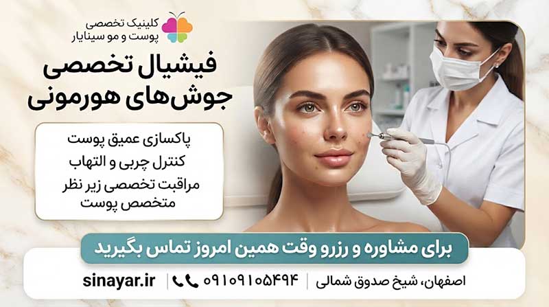 فیشیال برای جوش هورمونی