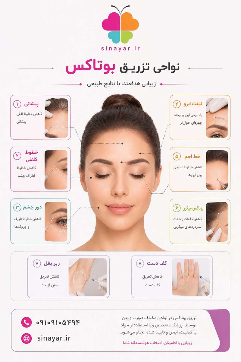 بوتاکس اصفهان
